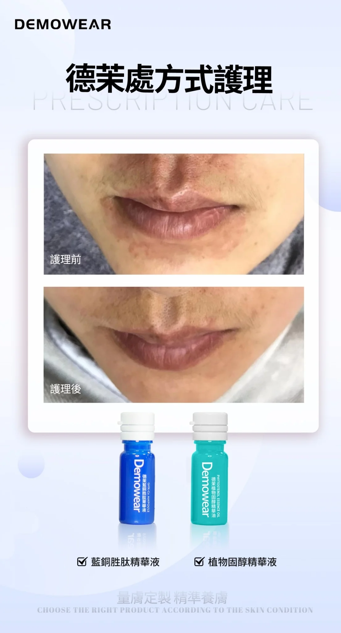Line Album 產品海報 241220 63